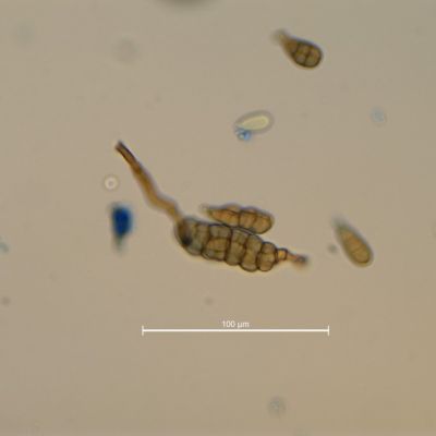 Foto InfantinoCREA-DC Alternaria3